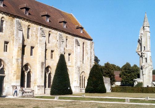 L'abbaye cistercienne royale de Royaumont. A droite, ruines de l'église abbatiale